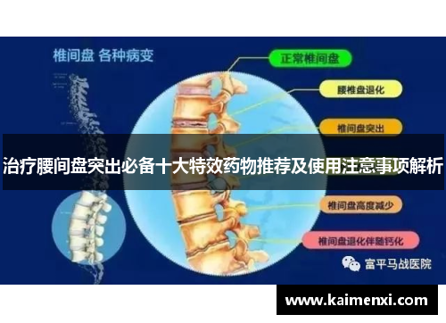 治疗腰间盘突出必备十大特效药物推荐及使用注意事项解析